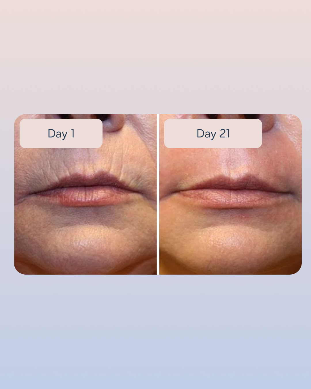 Hyaluronic Serum