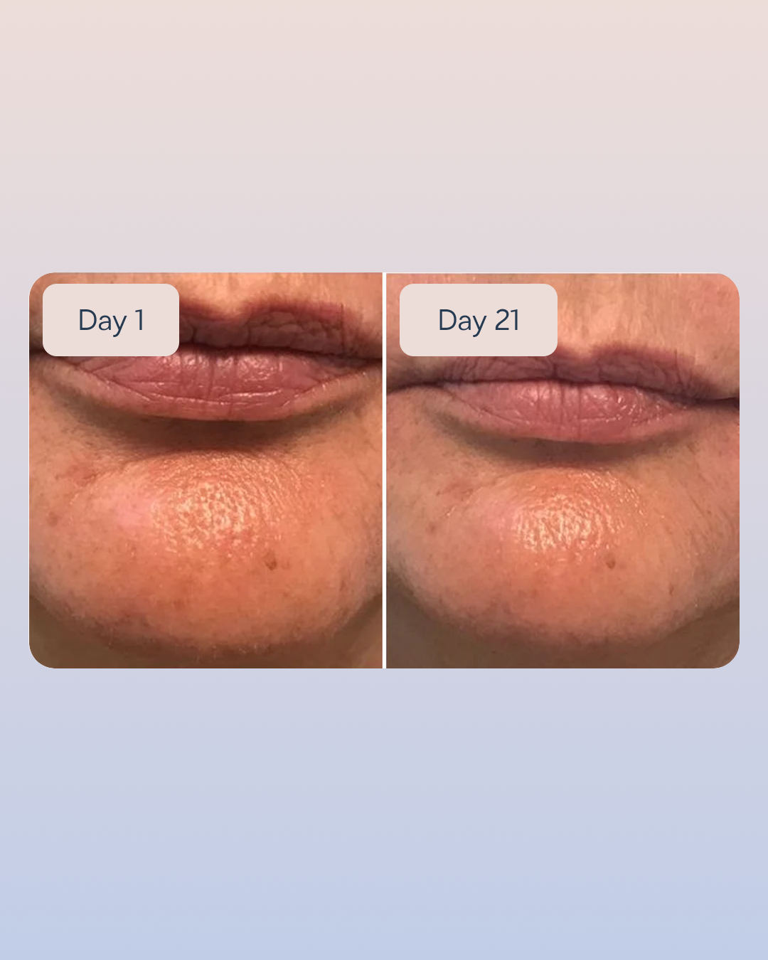 Hyaluronic Serum