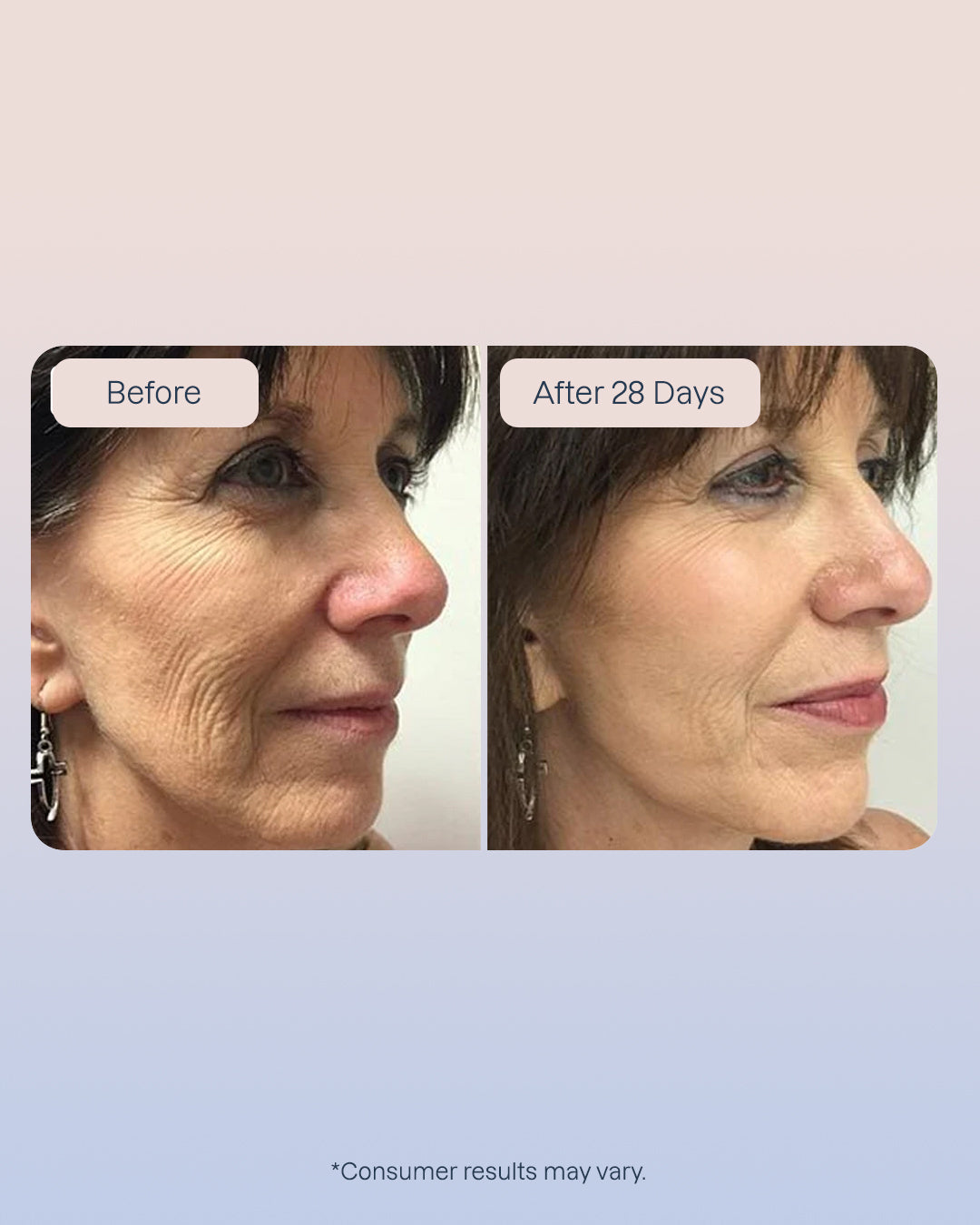 6 x Swiss Niacinamide Serum