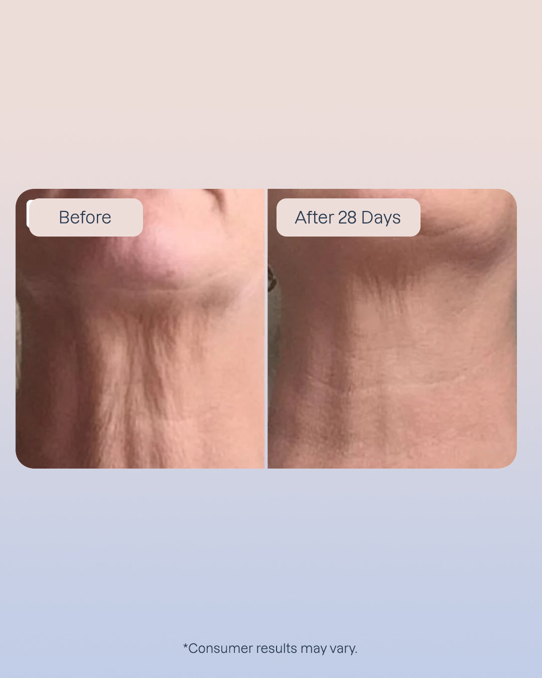 6 x Swiss Niacinamide Serum