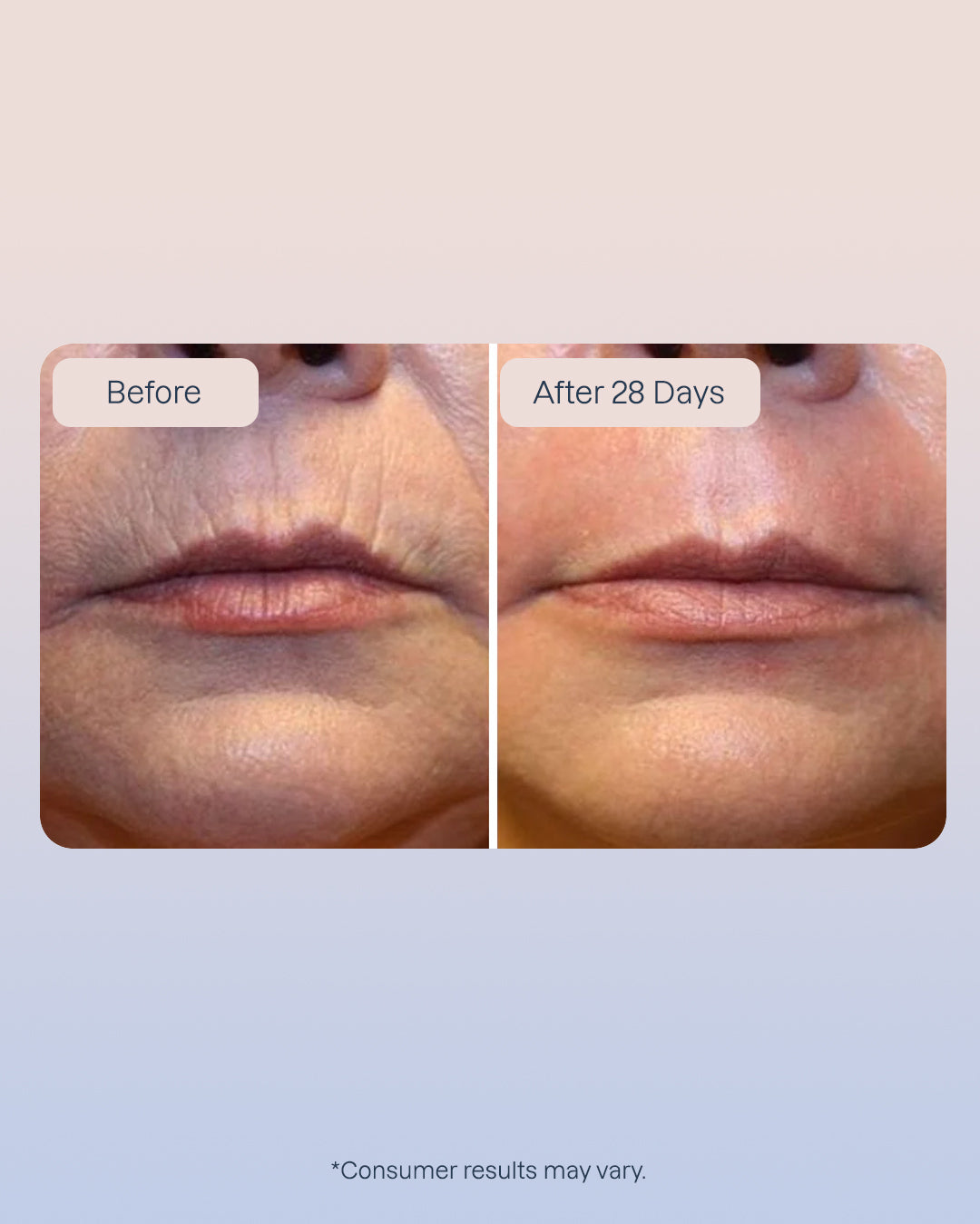 6 x Hyaluronic Serum