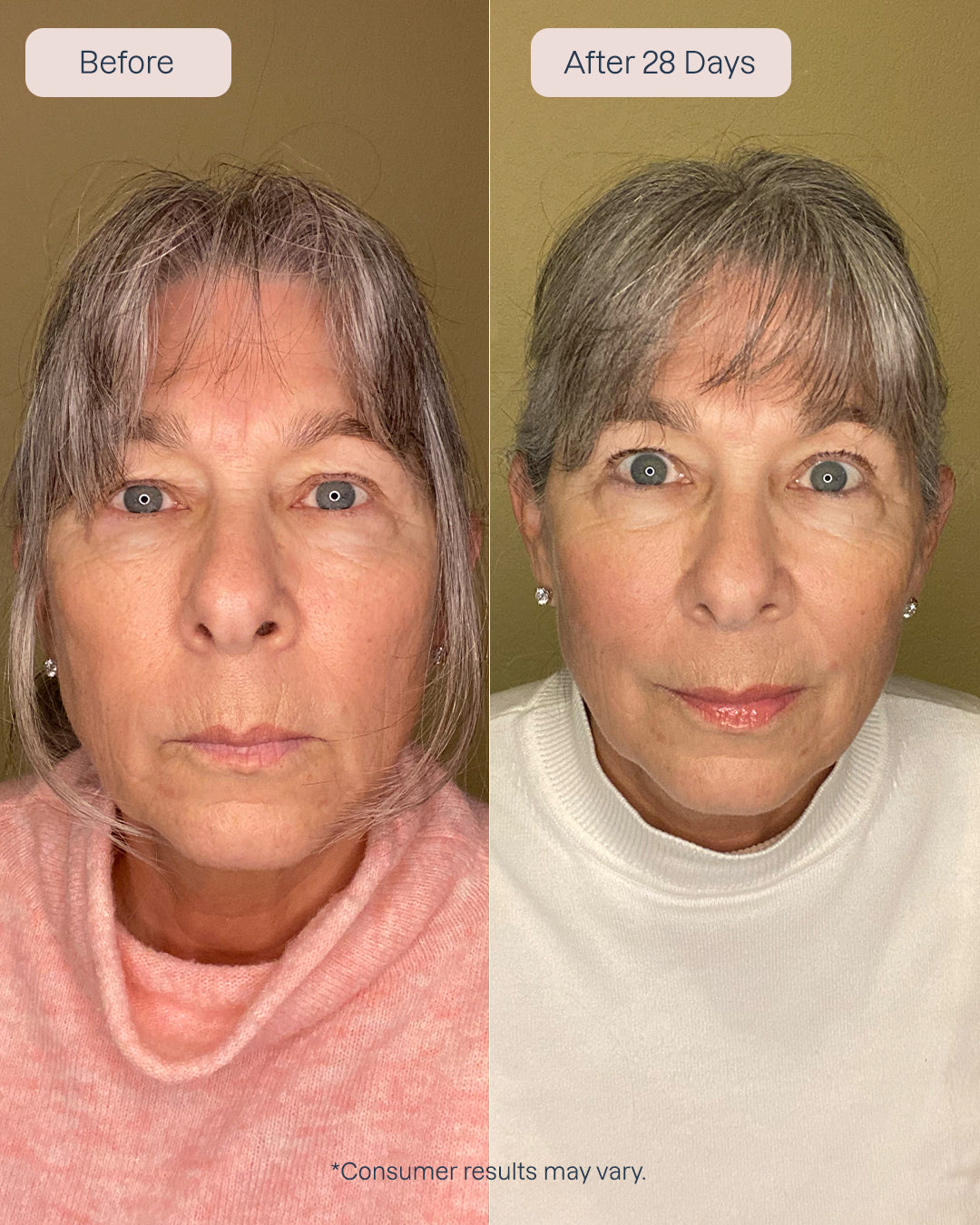 Renewa EyeLift + Renewa AgeDefy Serum