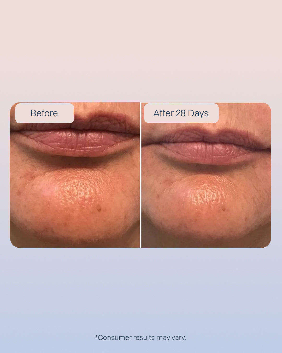 6 x Hyaluronic Serum