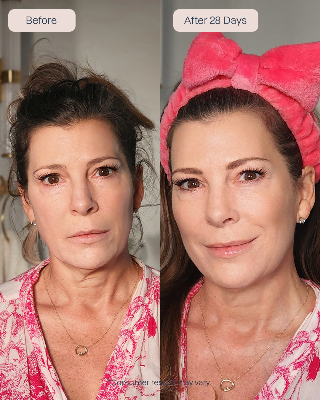 Renewa EyeLift + Renewa AgeDefy Serum