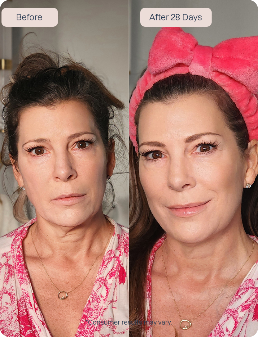 RenewaLift Device + Renewa AgeDefy Serum