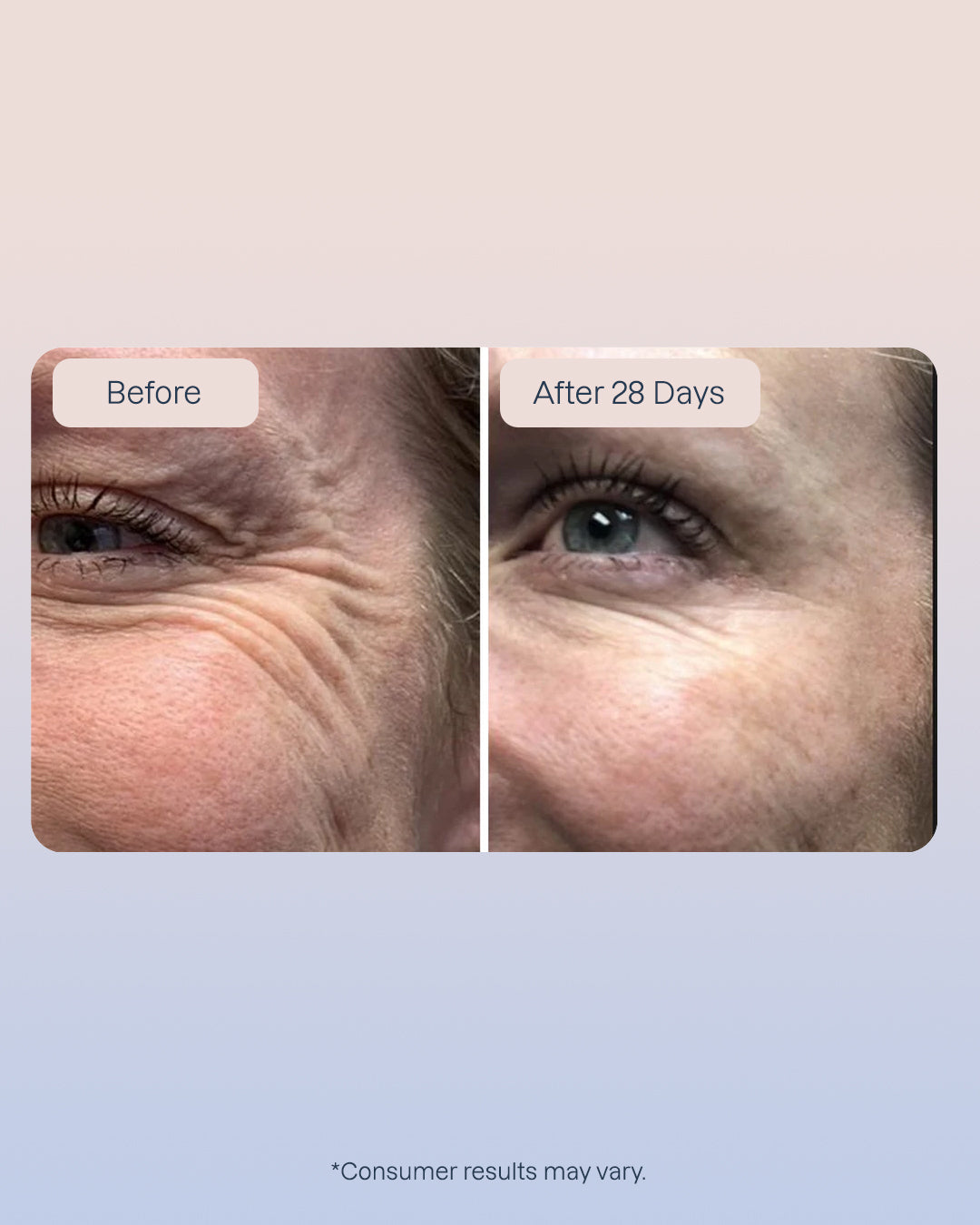 6 Golden Retinol Eye Cream