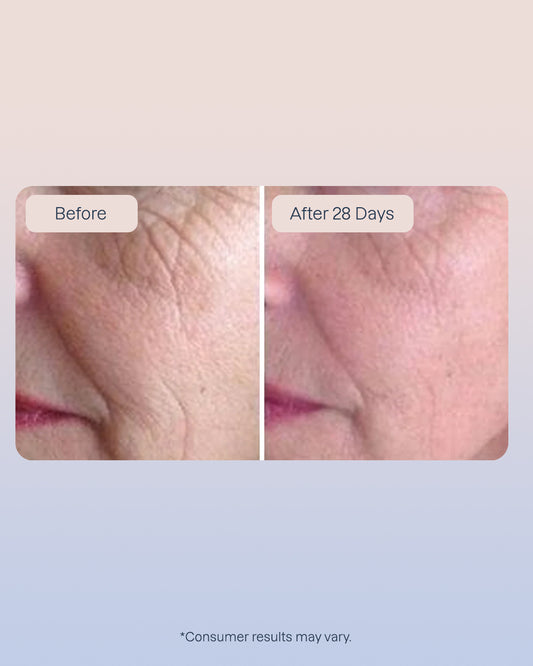 3 Golden Retinol Eye Cream