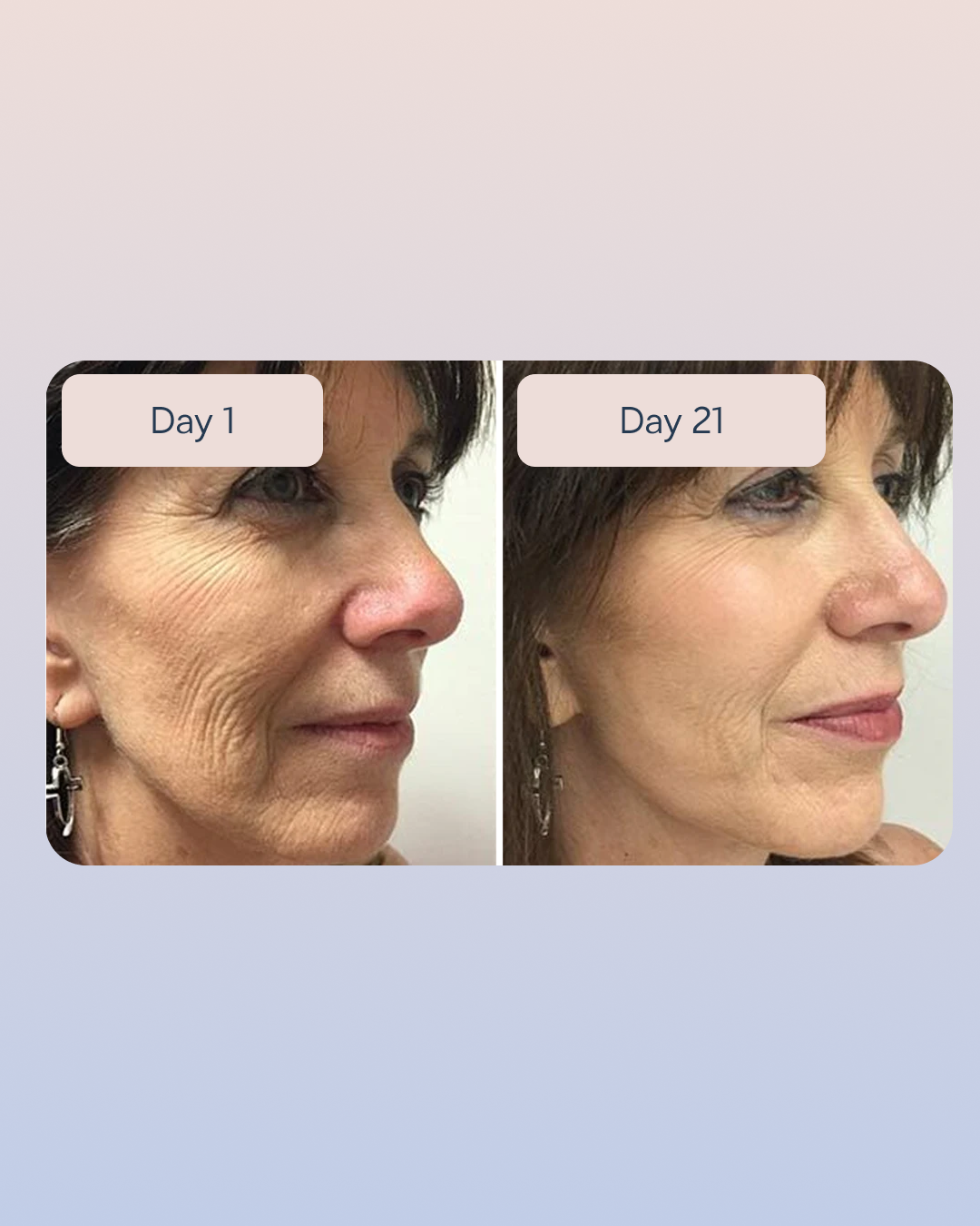Swiss Niacinamide Serum