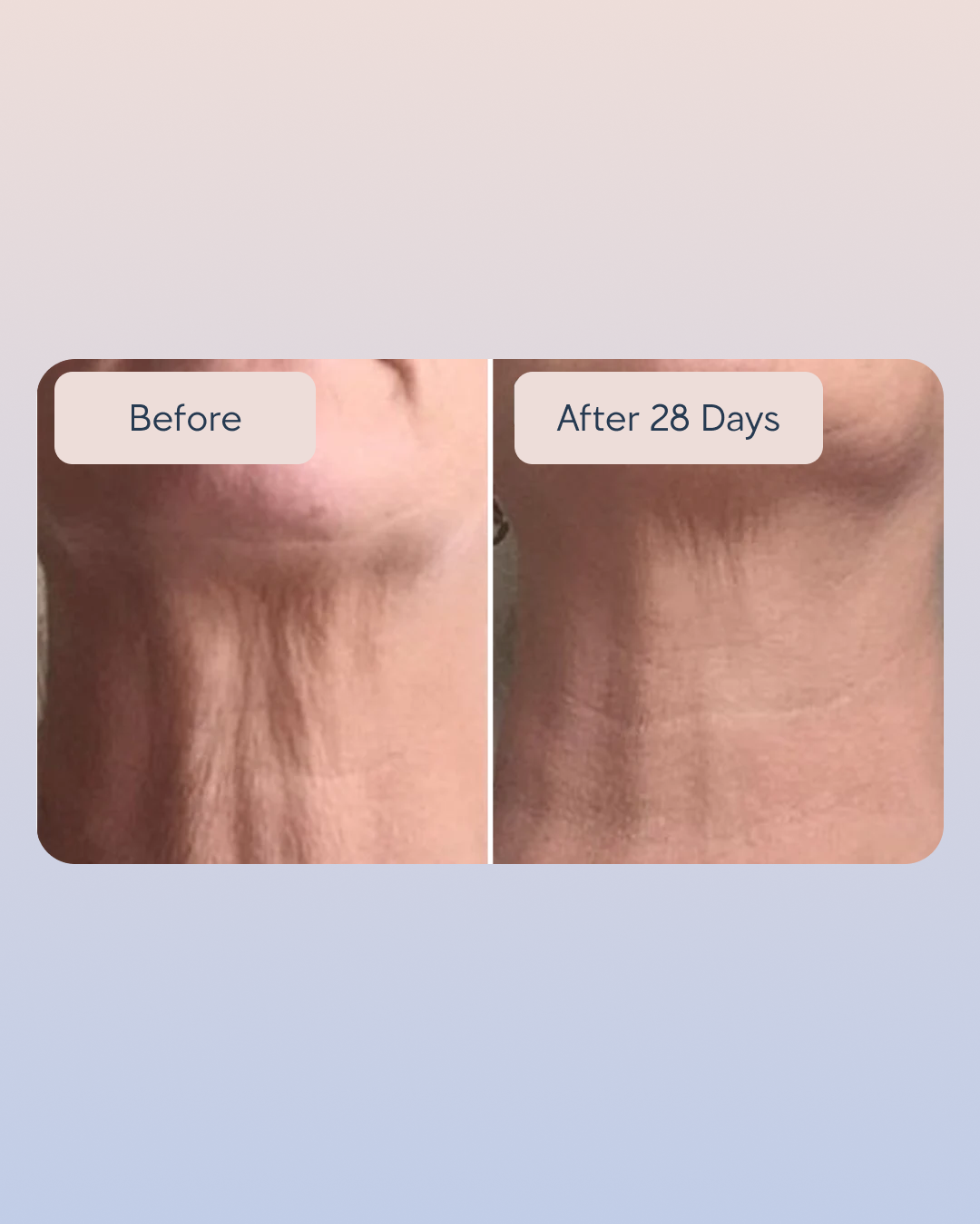 Swiss Niacinamide Serum