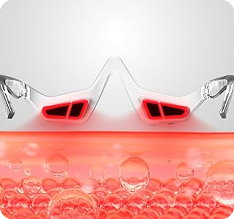 Renewa EyeLift™ Device