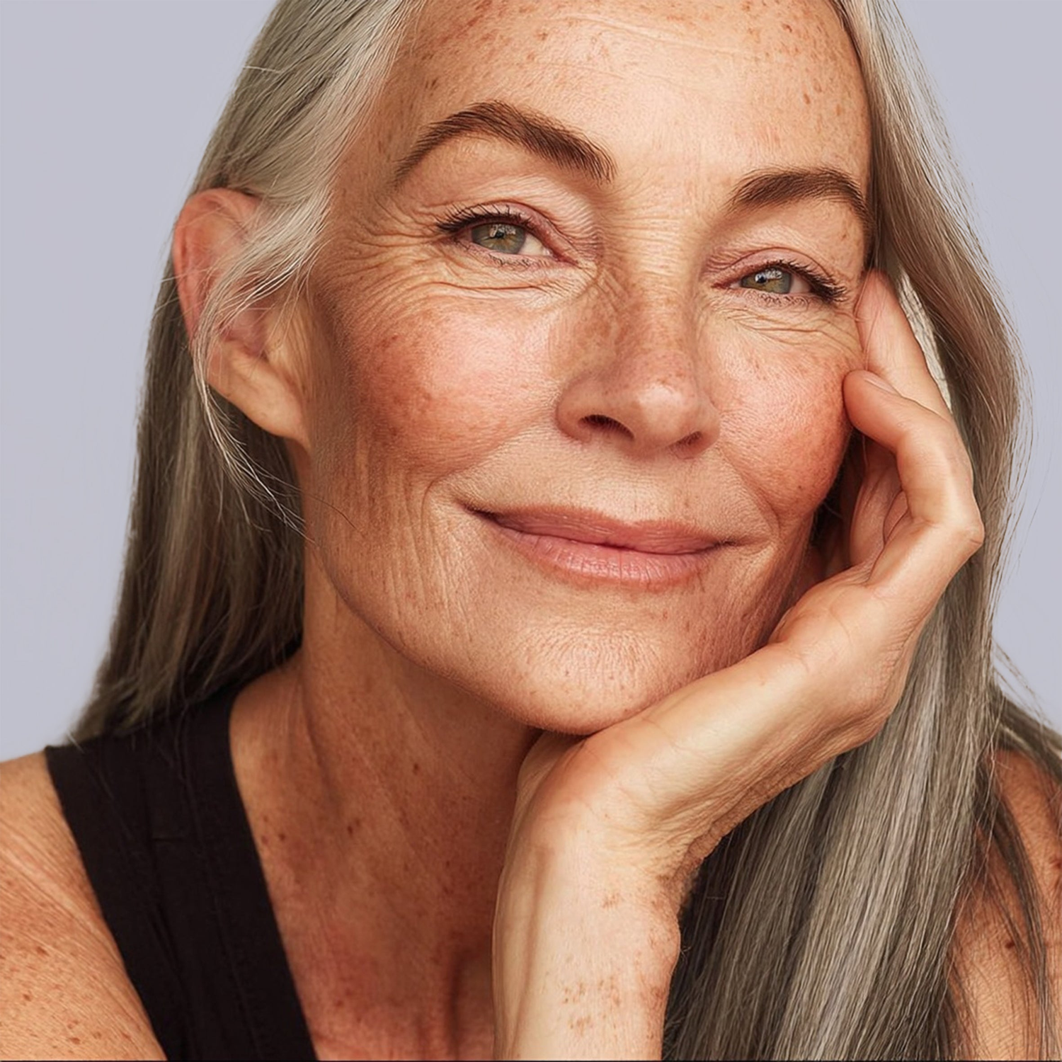 Aging Skin