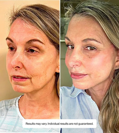 Hyaluronic Serum