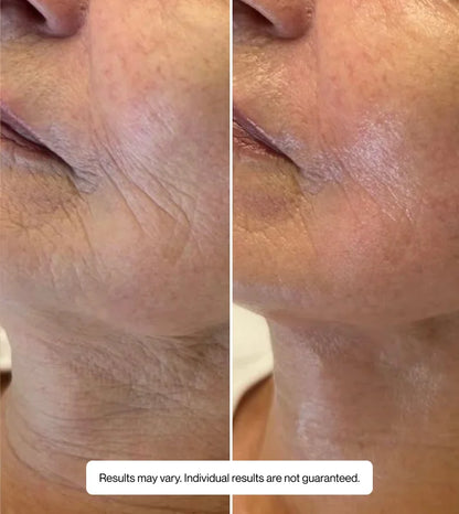 Hyaluronic Serum