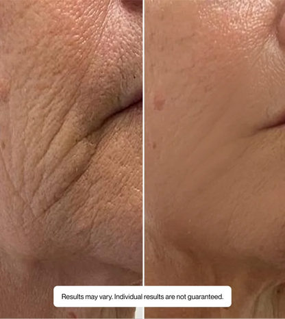 Hyaluronic Serum
