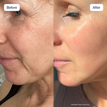 Hyaluronic Serum
