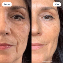 Renewa AgeDefy Serum