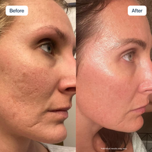 Renewa AgeDefy Serum