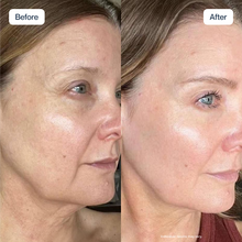 Hyaluronic Serum