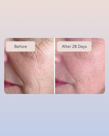 Golden Retinol Eye Cream