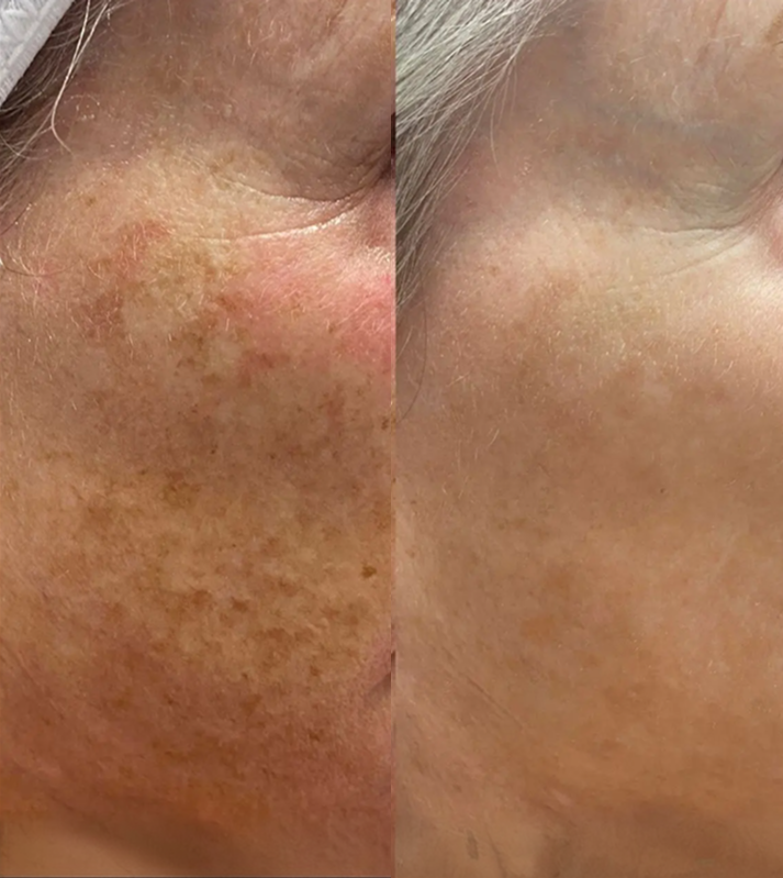 24K Gold Serum