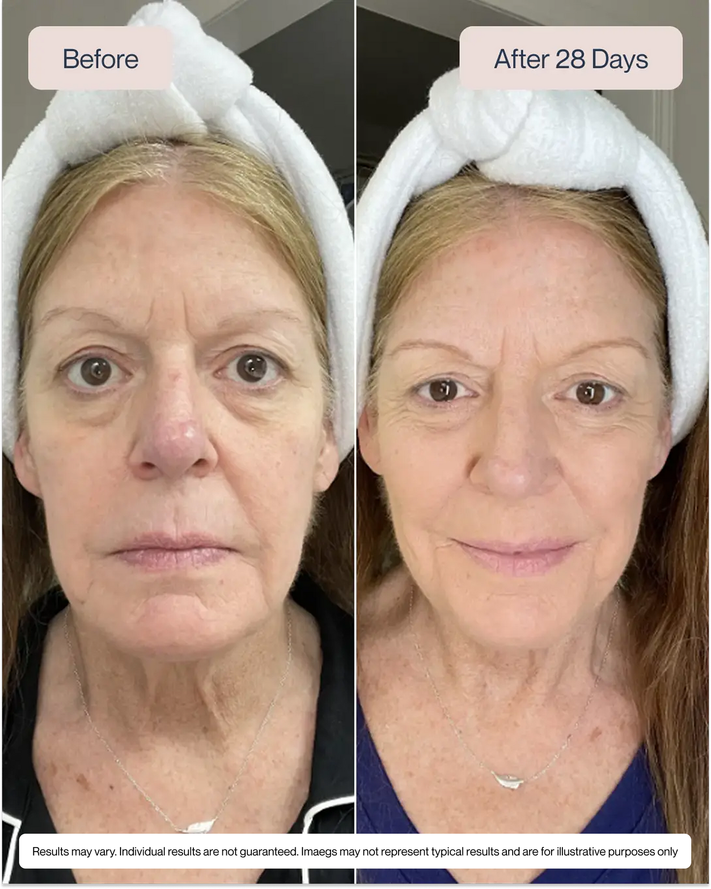 Renewa AgeDefy Serum