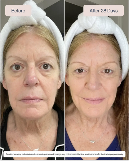 Renewa AgeDefy Serum