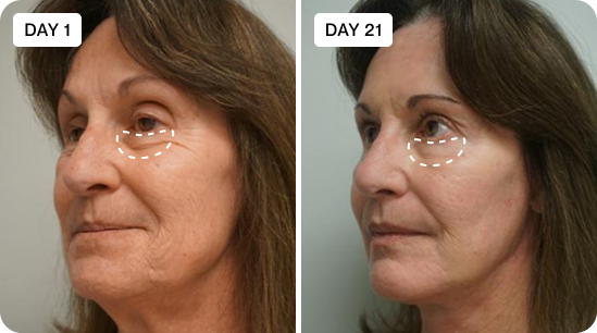 Before & After