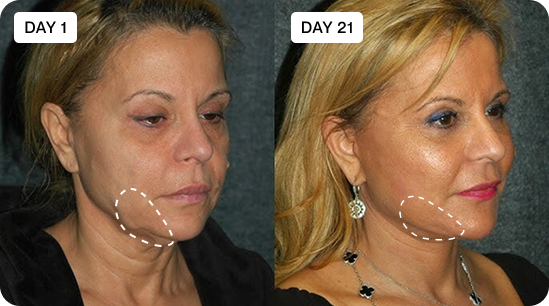 Before & After