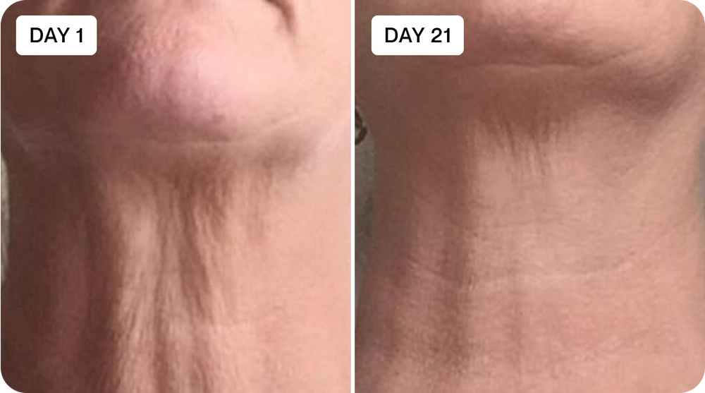 Before & After