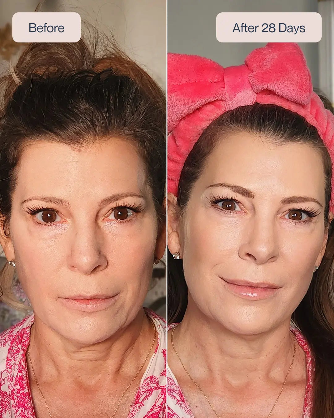 Renewa AgeDefy Serum