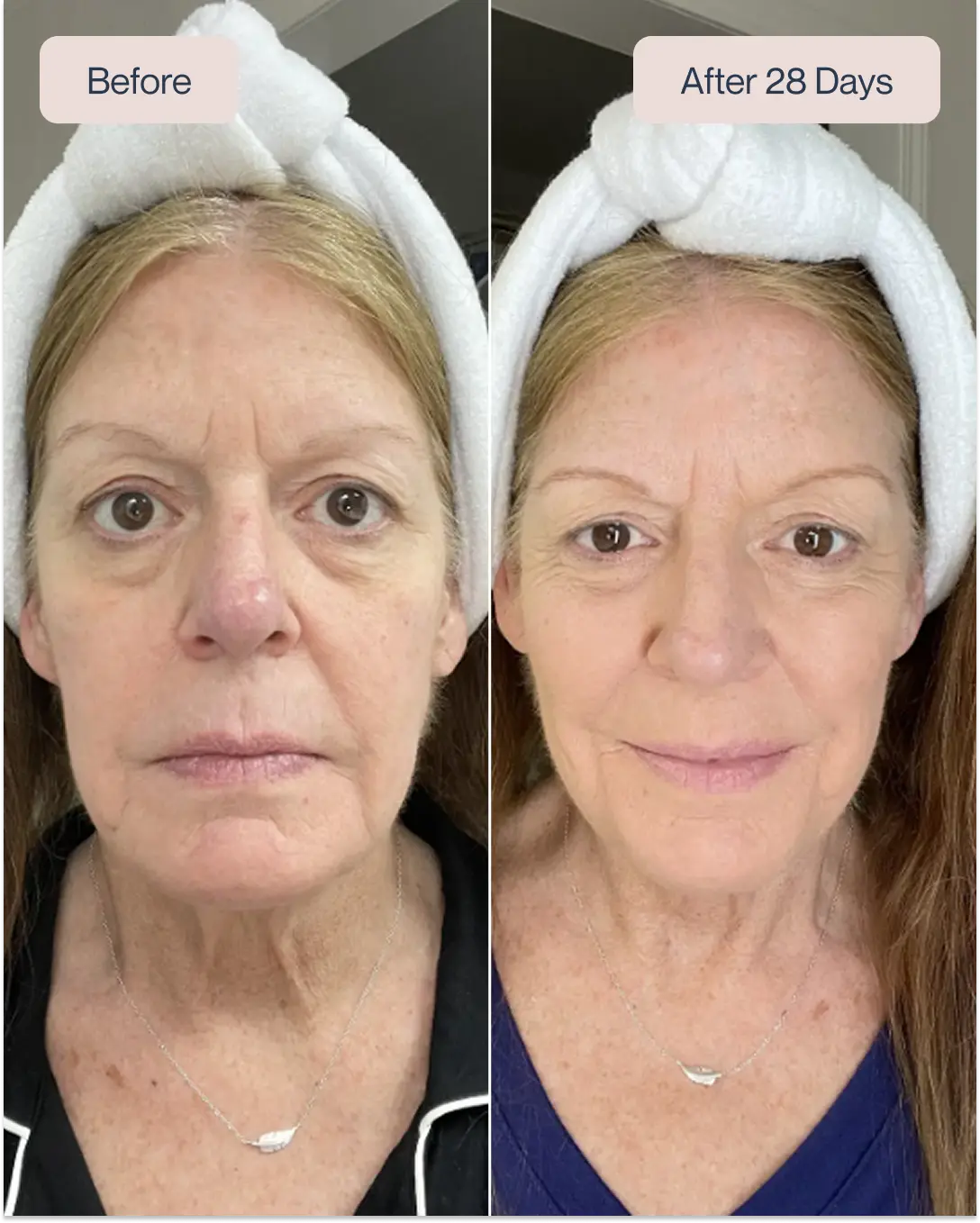 Renewa AgeDefy Serum