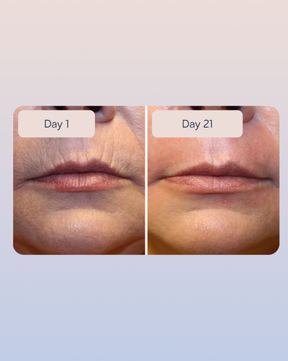 Hyaluronic Serum