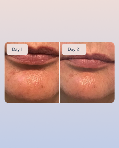 Hyaluronic Serum