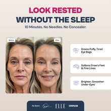 Renewa EyeLift