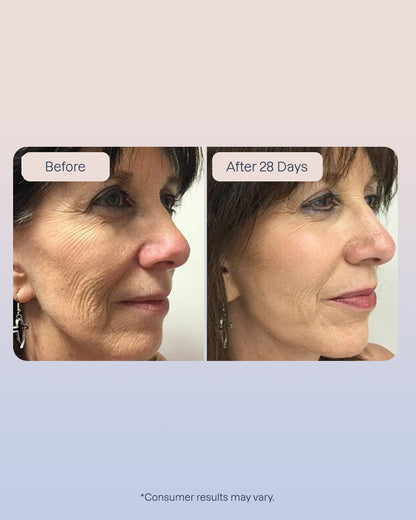 6 x Swiss Niacinamide Serum