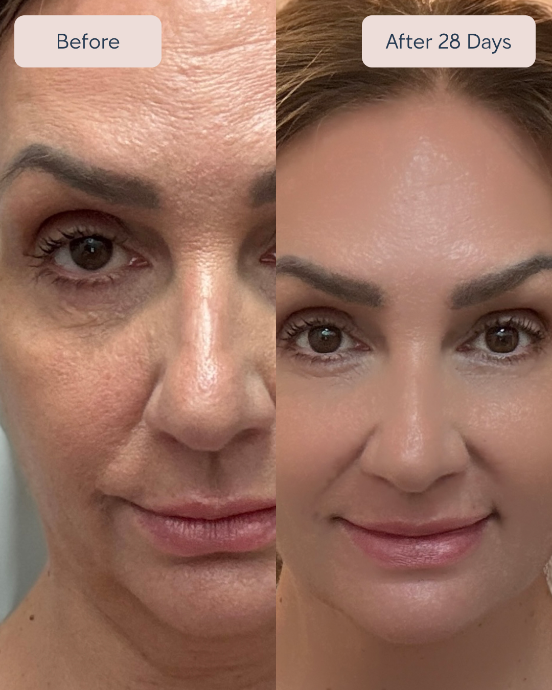 Renewa AgeDefy Serum