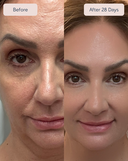 Renewa AgeDefy Serum