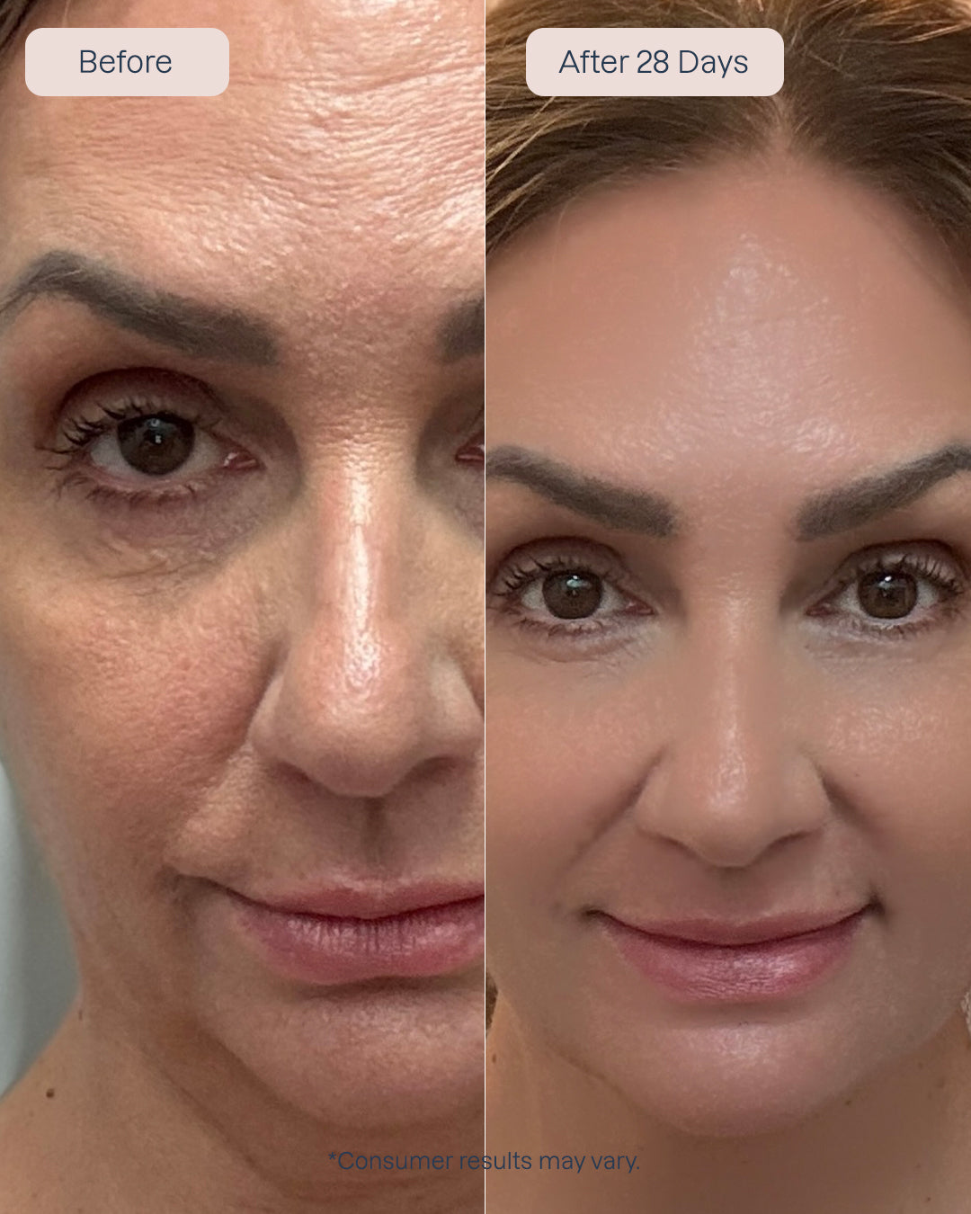 3 x Renewa AgeDefy Serum