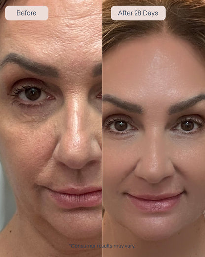 3 x Renewa AgeDefy Serum