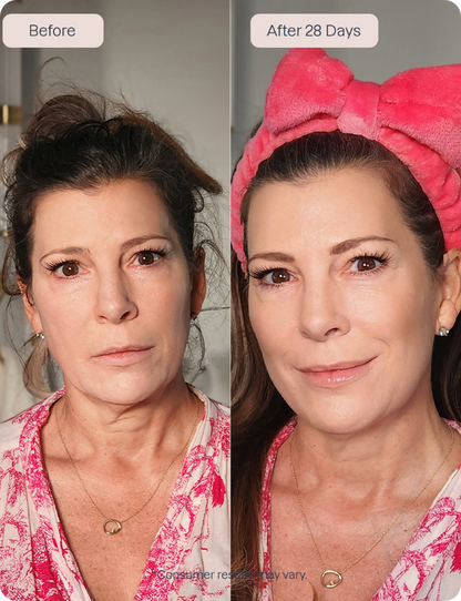 RenewaLift Device + Renewa AgeDefy Serum