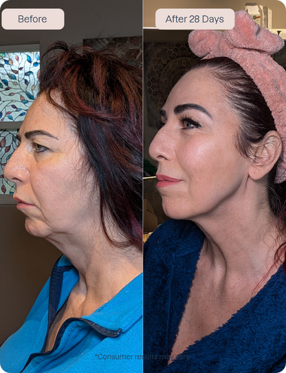 RenewaLift Device + Renewa AgeDefy Serum