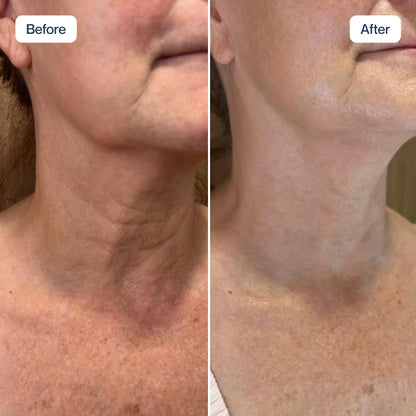 RenewaCell Serum