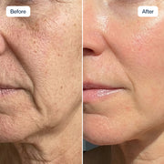 RenewaCell Serum