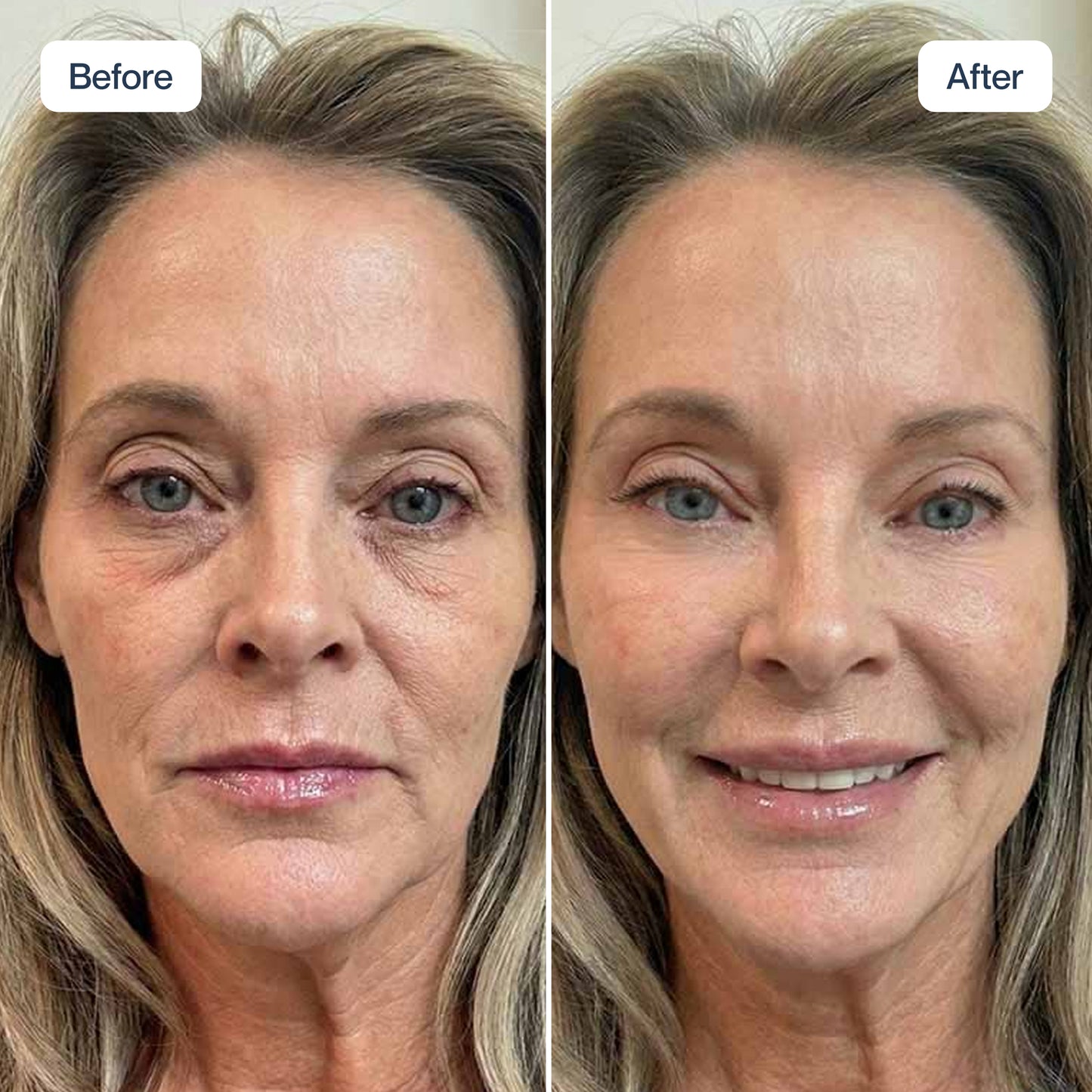 RenewaCell Serum