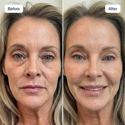 RenewaCell Serum