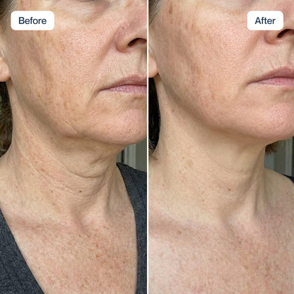 RenewaCell Serum