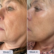 RenewaCell Serum