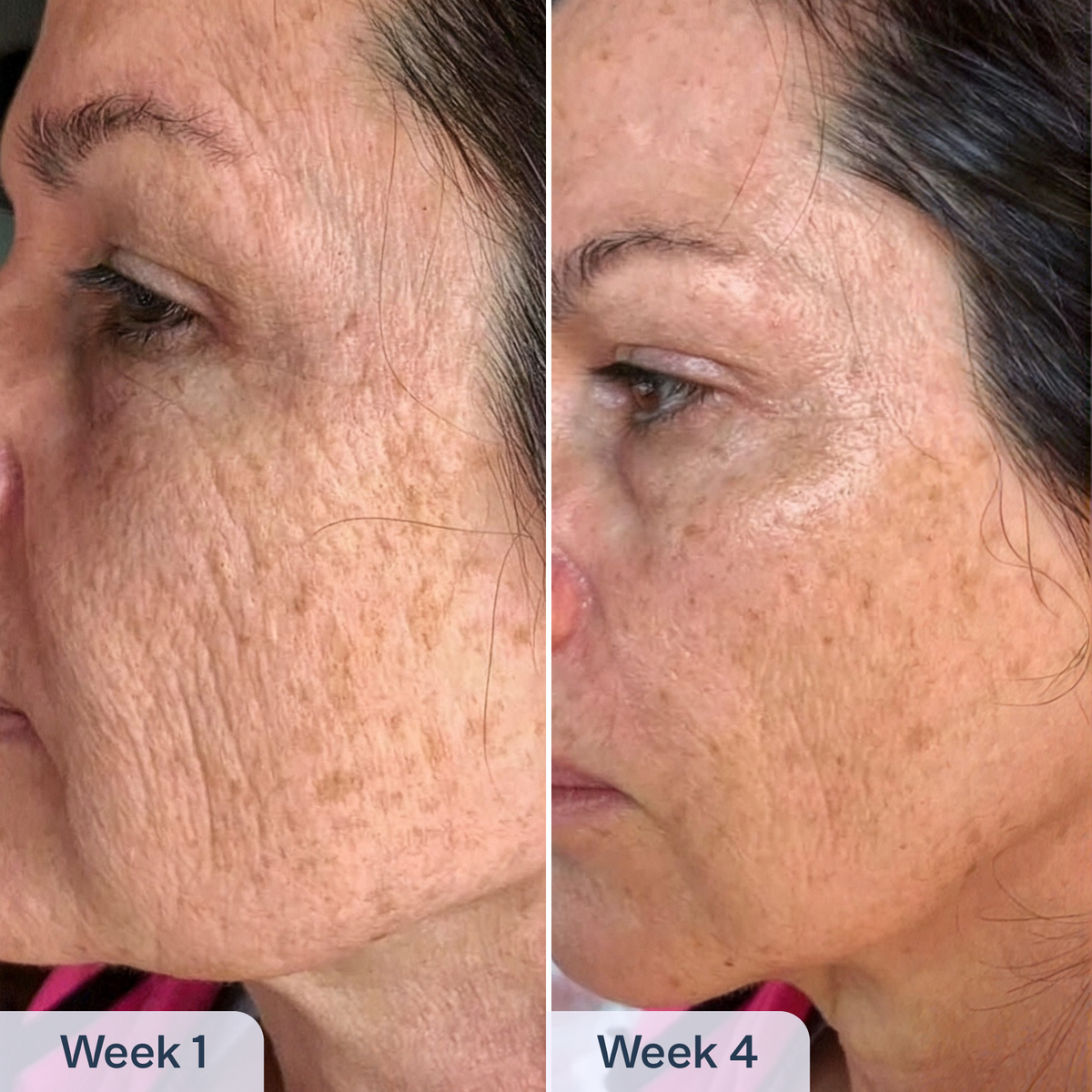 RenewaCell Serum