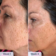 RenewaCell Serum