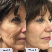 RenewaCell Serum